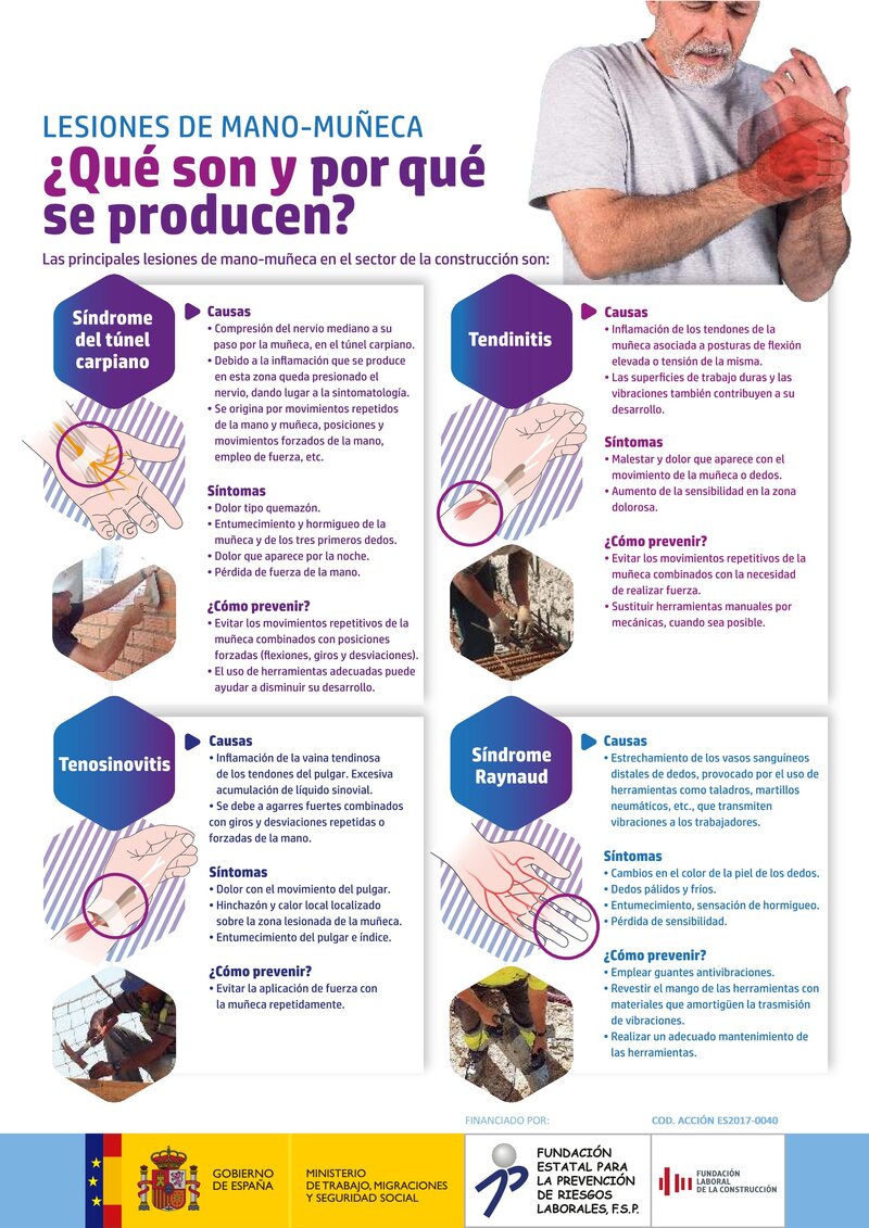Riesgos ergonómicos. Lesiones mano muñeca